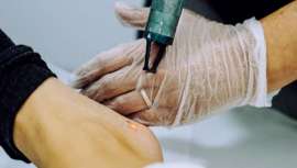 El desamor es el tercer motivo por el que se decide eliminar un tatuaje; por detrás del cansancio y la antigüedad, según el centro madrileño especializado Tatualia Chueca