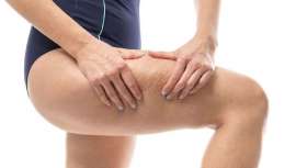 Soliton anuncia que su tecnología RAP (Pulso Acústico Rápido) para la mejora a corto plazo en la apariencia de la celulitis utilizando el poder del sonido ya está aprobada para su uso