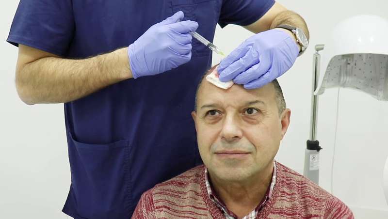 Terapia de c�lulas madre contra la ca�da del cabello