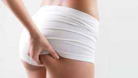 Te presentamos lo último en medicina estética para lograr tener un trasero a lo Kim Kardashian sin intervención del bisturí