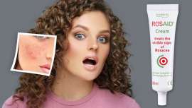 Este tratamiento multifactorial es la novedad para ayudar a las pieles más sensibles o que sufren este tipo de afecciones cutáneas