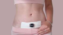 Terapia que trata y previene cicatrices y queloides tras cirugías incisionales y otros procedimientos, basa su acción en la silicona, el calor infrarrojo y el alivio de la tensión