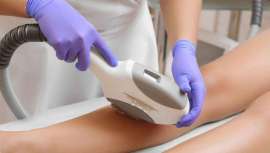 Cinc Estética recomienda el tratamiento de láser más avanzado, la fotodepilación, para eliminar el vello para siempre, de una forma eficaz e indolora