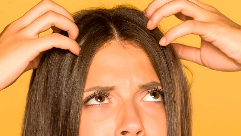 ¿Tienes el cuero cabelludo graso? Descubre sus causas y posibles tratamientos