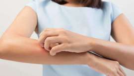 Complemento de la dieta, recomendado y producto estrella de Clínica Cres, Regenera VITT cuenta con el activo PEY, que reduce la inflamación sistémica del intestino, presente en la psoriasis