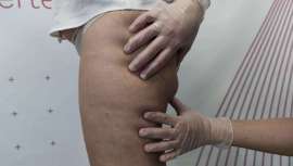 El crecimiento del negocio solo se asegura con el reciclaje y el desarrollo. Estetiplan lo sabe y diseña un curso a la última. Conviértete en un experto en Diagnóstico Corporal y hazlo de la mano de los mejores 