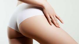 Reformatea casi cualquier tipo de glúteo con un tratamiento basado en el uso del nuevo ácido poliláctico