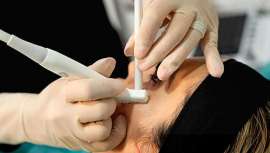 Merz Aesthetics España y Portugal se une a la compañía Prouson para lanzar esta revolucionaria tecnología de ecografía en tiempo real para medicina estética