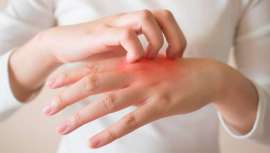 Más de dos tercios del público ahora pueden tener dermatitis en las manos debido al lavado de manos riguroso y al uso de desinfectantes a base de alcohol durante la pandemia de Covid-19. Debate y conclusiones del Simposio de primavera 2021 EADV