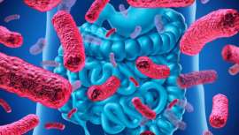 La HS, Hidradenitis supurativa o afección cutánea dolorosa, crónica y recidivante, en relación directa con el desequilibrio de la microbiota intestinal