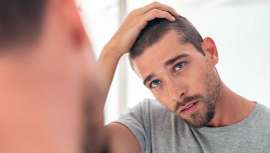 Entre las ventajas para el paciente de realizarse un injerto capilar durante los meses veraniegos está el descanso vacacional que ayuda al postoperatorio y la vuelta al trabajo con pelo en fase de crecimiento