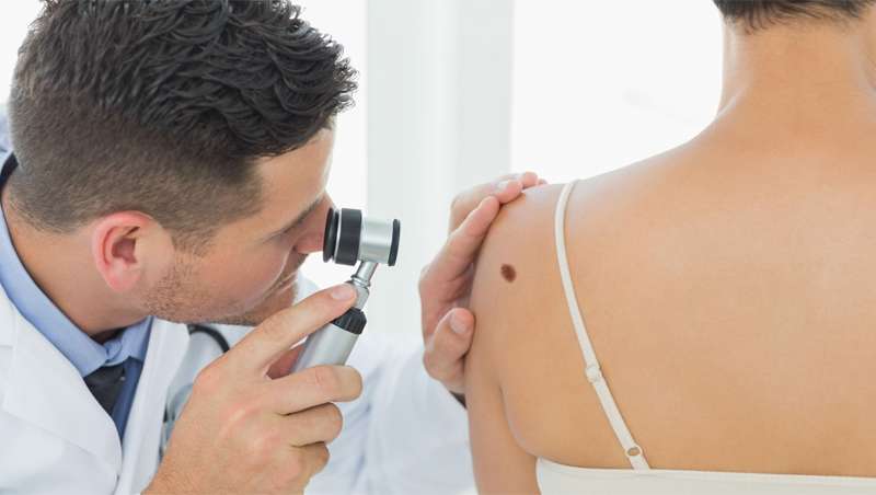 Piel sana con mesoestetic, contra el melanoma