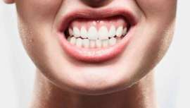 El 70% de la población española sufre bruxismo, una patología que está ligada a estados nerviosos o de ansiedad. El Doctor Andrés Sanchéz Monescillo explica cuáles son los síntomas principales y cómo evitar el desgaste de los dientes