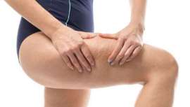 Dispositivo contra la celulitis, recientemente aprobado por la FDA, con altísimo porcentaje de satisfacción entre pacientes en la mejora de la celulitis a corto plazo