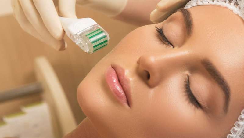 El microneedling conquista a los institutos franceses