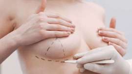 La reconstrucción mamaria sube un 29%, mientras que en lo referido a procedimientos mínimamente invasivos la toxina botulínica sigue encabezando la lista de intervenciones entre mujeres que planean gastar más en medicina y cirugía estética en 2021