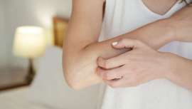 Un estudio encuentra que los enfermos de psoriasis podrían mejorar la enfermedad al reducir la ingesta de grasa y azúcar