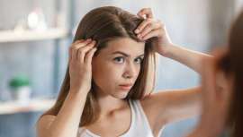 A diferencia de la alopecia, se trata de un problema reversible que tiene su origen en una causa concreta. Tras el confinamiento se incrementan las consultas acerca de la caída de pelo excesiva