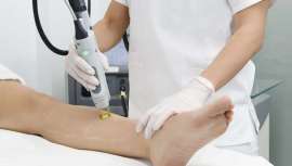 Dermitek Barcelona descubre todo lo que debes saber sobre la depilación láser en la estación donde más exponemos nuestra piel al sol