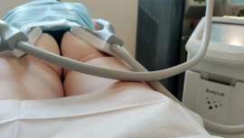 Reducir la grasa, aumentar y tonificar la musculatura en pocas sesiones, el sistema BodyLab lo hace posible. La estimulación neuromuscular puede reducir sin esfuerzo la grasa no deseada y aumentar la musculatura con una intensidad de 2,5T