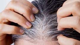 O cabelo grisalho aparece ainda mais sob condições de stress, segundo um último estudo, mas existe uma solução que nos assegura reverter o envelhecimento e também os grisalhos 