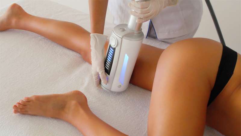 Endosphres Therapy, inovao no tratamento da celulite