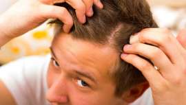 Según un último estudio, el sulforafano, un compuesto orgánico presente en alimentos como el brócoli y la coliflor, podría ayudar a prevenir la pérdida de cabello e incluso aumentar su crecimiento