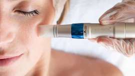 Este nuevo dispositivo de micropunción de Mediderma es ligero e inalámbrico, y estimula la producción de colágeno, además de favorecer la absorción de principios activos