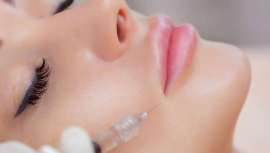 El relleno de ácido hialurónico utilizado en más de 50 millones de tratamientos en todo el mundo