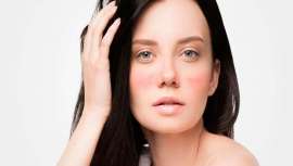 Olyan farma lanza el primer producto sanitario para el tratamiento y la prevención de las telangiectasias