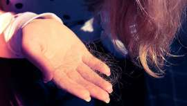 Esta alopecia se trata de un efecto adverso temporal que se podrá controlar una vez que la afección se estabilice