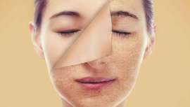 Personas que sufren lesiones o enfermedades que deforman la visión de sus rostros o cuerpos, llenan las consultas de psicólogos y psiquiatras.