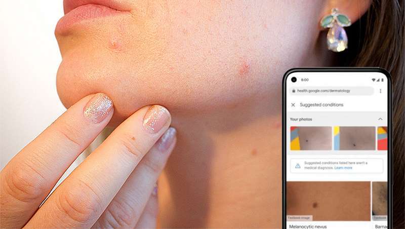 Google fixa-se na pele dos seus utilizadores e analisa-a