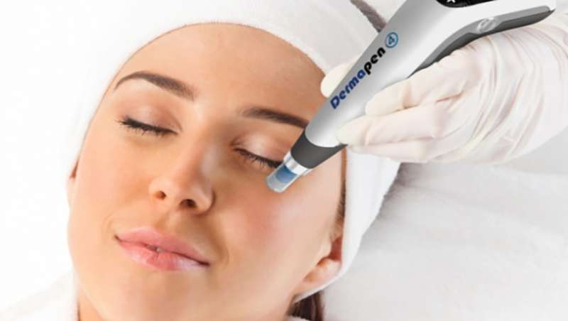 Dermapen PRO con microagujas