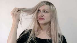 Este trastorno crónico de la piel afecta al cuero cabelludo, donde aparecen zonas inflamadas y caspa persistente. Pero a través de una dieta equilibrada, evitando la sudoración intensa o rascarse la cabeza con frecuencia, se puede prevenir