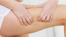 Son muchos factores los que intervienen en el proceso de la celulitis, pero uno de ellos, el más significativo, es el que ocurre a nivel hormonal