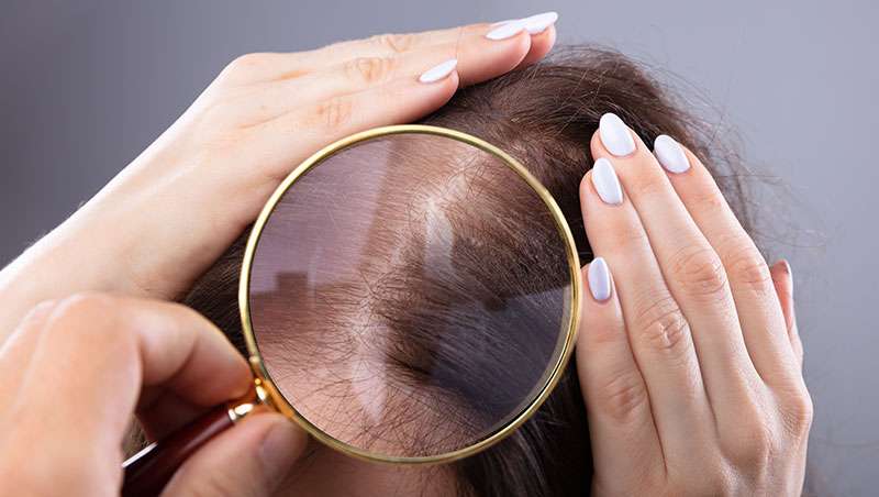 Porosidad del cabello, cómo identificarla y actuar