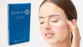 Aprobado por la FDA, Radiasse (+) demuestra su eficacia en el tratamiento de la línea mandibular 