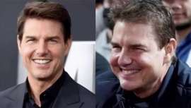 Un mal asesoramiento y la sobreindicación de rellenos en contraposición de utilizar hilos tensores o un lífting facial son la razón del rostro casi irreconocible de actor de la Cienciología, otrora el guapo de Top Gun, asegura el Dr. Óscar Junco