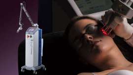 Gracias a la evolución e investigación en medicina estética, se ha desarrollado el láser fraccional de CO2 de última generación de DEKA by LaserTech Ibérica por el que apuesta el Dr. Moisés Amselem en su centro