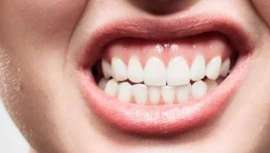 La Dra. Eugenia Cervantes, odontóloga especializada en estética dental en la Clínica Eugenia Cervantes nos habla de este trastorno y de la importancia de cuidar nuestra salud dental al igual que la mental