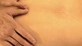 Desde la identificación de la cicatriz y hasta llegar al tipo de masaje requerido por las cicatrices poscirugía, revisamos con la experta diplomada, Pilar Muñoz Correcher, los pasos a aplicar en el centro de belleza para su tratamiento y resolución