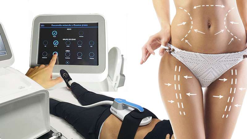 Tratamiento de la distasis abdominal con ondas electromagnticas focalizadas HIFEW de Tecnoesthetic