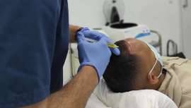 La clínica de salud y medicina capilar MC360 presenta PRC, Protocolo de Redensificación Capilar, que brinda al paciente los mejores y más rigurosos resultados en el tratamiento de su cabello