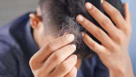 Será en una ponencia en Beauty Contact País Vasco-Bilbao, que va a tener lugar los días 5 y 6 de junio, para el global de los profesionales de la belleza preocupados por dar respuesta a sus clientes y pacientes al respecto de la caída del cabello