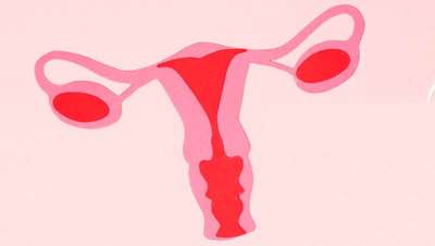 Cáncer de ovario, vamos a prevenir