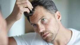 El tabaco puede tener consecuencias para la piel, los dientes, y para sorpresa de muchos, también para el cabello