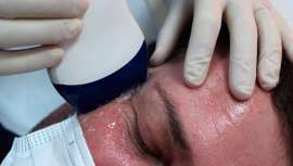 Nuevos Cursos de Técnicas de Medicina Estética y Taller Práctico de Ecografía el 14 de mayo, en Toledo