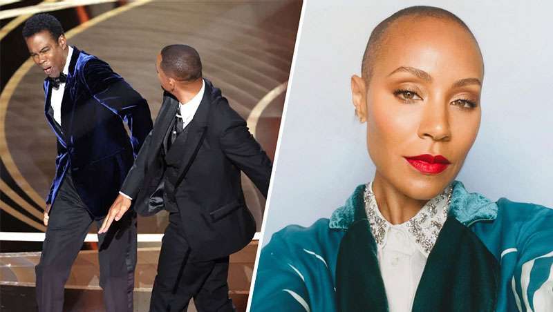 Alopecia feminina nos Óscares de Hollywood