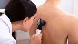 Una abultada cifra y que une otra coordenada alarmante, el cáncer de piel es prevenible en la mayoría de los casos con la atención adecuada al ser causado en su mayoría por la exposición al sol